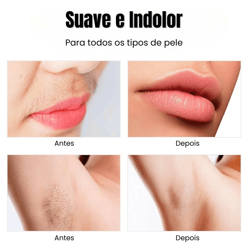 AllureGlam  8 em 1 - Depilador Elétrico Indolor Feminino